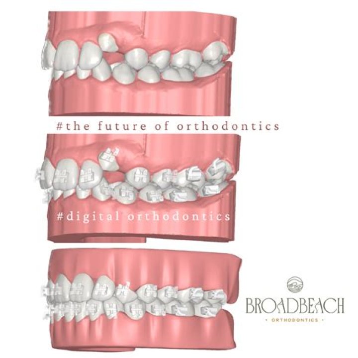 Orthodontist Expert Gold Coast Robina I Amazing Ways to Smile with Style